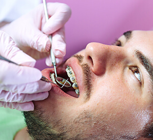 Man with braces undergoing dental examination