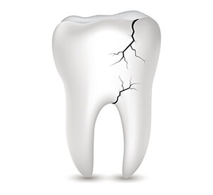 Cartoon teeth with cracks