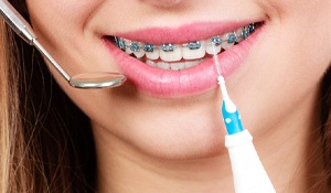 Patient with Delta insurance — close-up of smile with braces