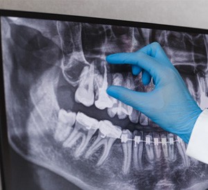 specialist looking at a digital X-ray