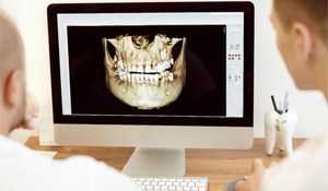 Computer monitor showing patient’s jawbone and structure before treatment  