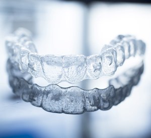 Close-up of clear aligner