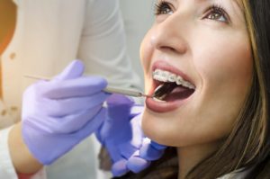 woman brown hair braces smiling