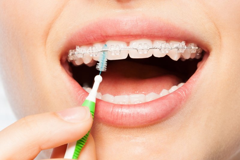 Patient cleaning their braces with special tool