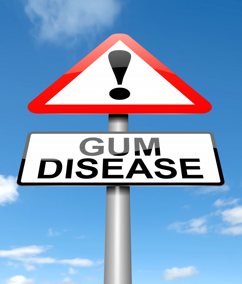 Sign saying gum disease