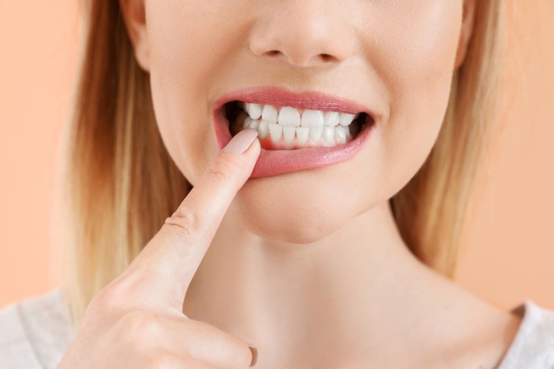 Woman showing gums free of gum disease